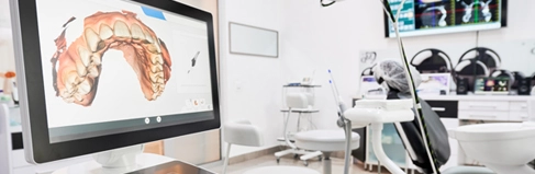 3D Scanning and CEREC technology