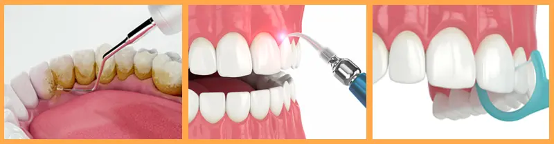 Examples of general dentistry at Foothills Dental