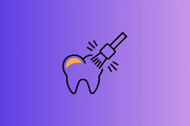 Imagen destacada de Foothills Dental sobre blanqueamiento dental
